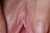 MION 2|#83