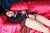 ERIKO|#68