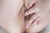 RURUNA|#101