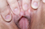 RURUNA|#157