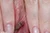 ANRI|#158