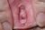 SOMEKA|#156