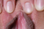 SONOE 2|#111