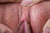MASAE|#155