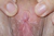 CHIERI|#156