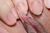 YUKIMI 2|#158