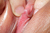 ATSUMI 2|#156