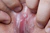 YURINE|#158