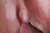 HIDEMI|#145