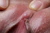 HIDEMI|#146