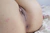 RENA 2|#43