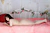 MOEKO|#118
