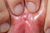 ETSUKO|#157