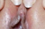 NATSUNO|#157